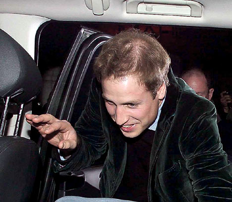 prince william face. Prince William is losing his